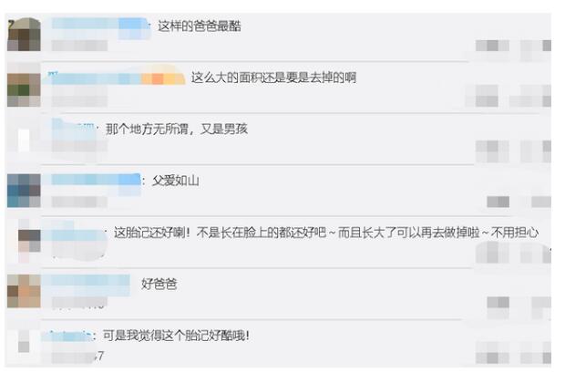 父爱如山!爸爸定制儿子同款胎记纹身贴纸什么情况?具体怎么回事?