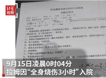 多次家暴！姐姐讲述拉姆遭前夫纵火烧伤过程 前夫为什么要纵火烧伤拉姆