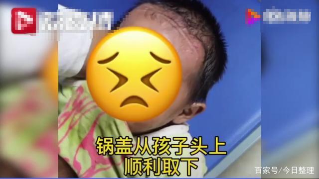 【熊孩子】徐州一男孩脑袋卡进锅盖取不下来 医院无奈只有求救消防