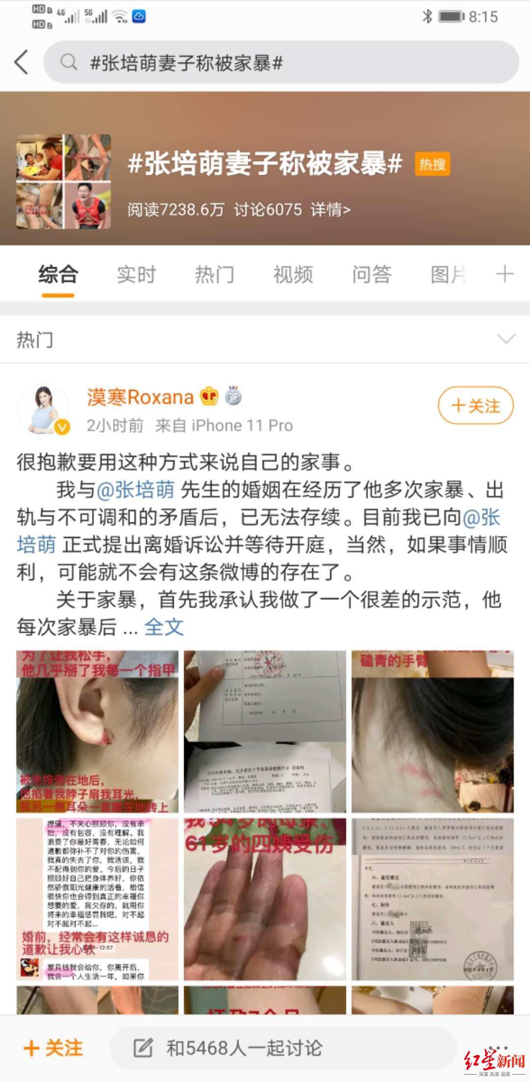 反转？张培萌妻子称只想要女儿抚养权，到底是啥情况？