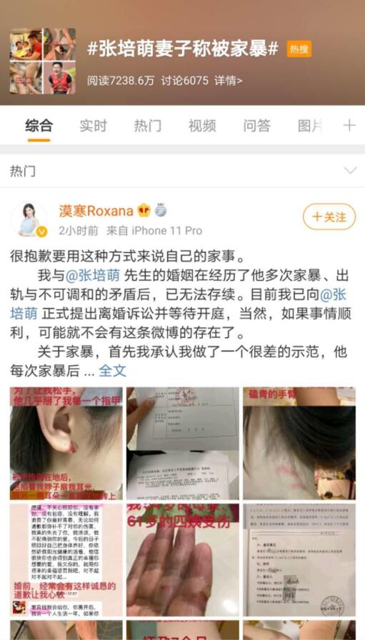 疑点重重！张培萌妻子称只想要女儿抚养权 张培萌发声否认出轨