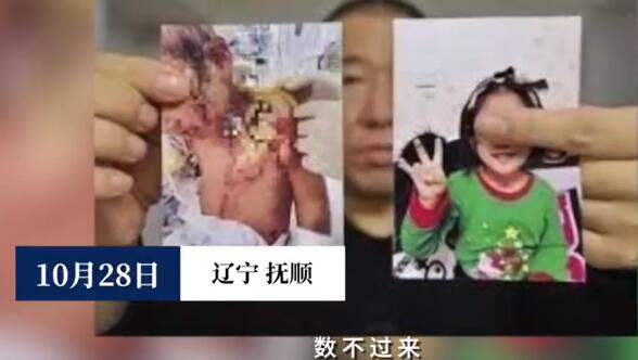 太残忍了！抚顺6岁被虐女童父亲望严惩前妻上热搜