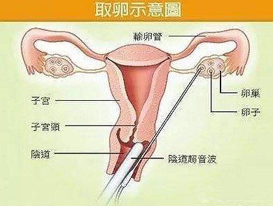 央视评代孕弃养!郑爽回应代孕弃养:我没有违背国家的指示